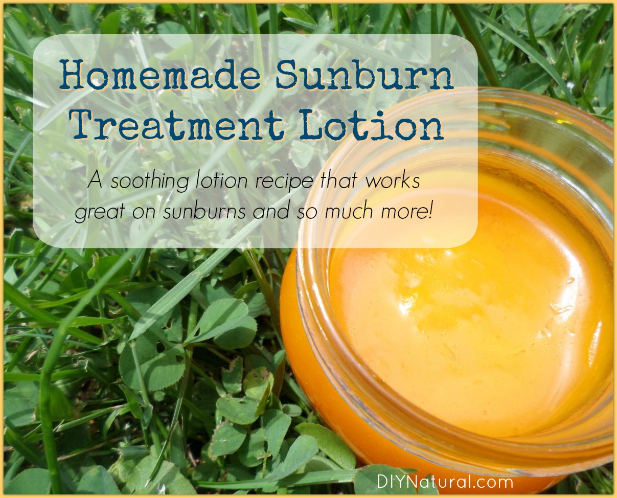 home remedy treatments for sunburn in horses