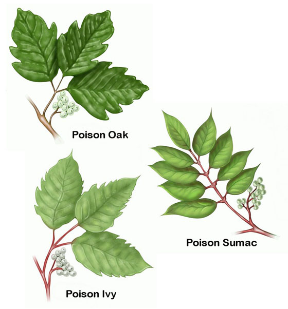 Poison Ivy Treatment