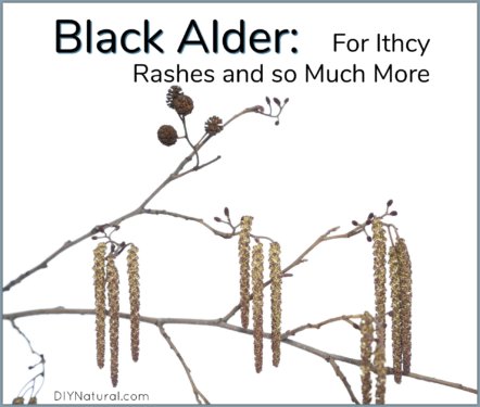 Black Elder Itchy Rash Remedies