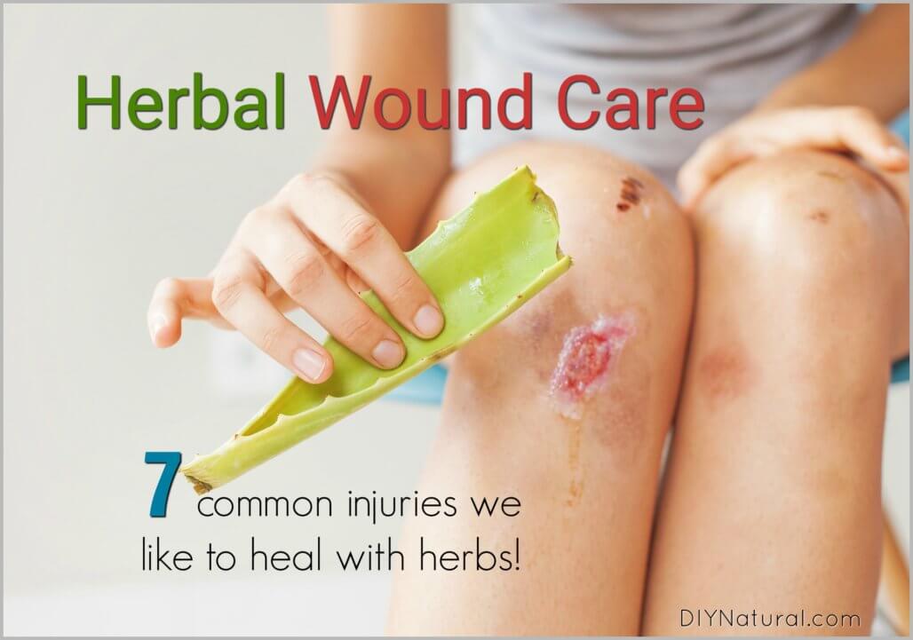 Healing Herbs for Wounds