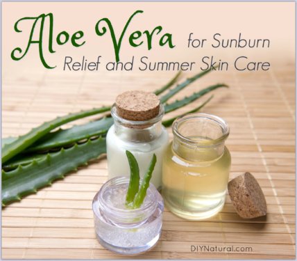 Home Remedies for Sunburn Aloe Vera