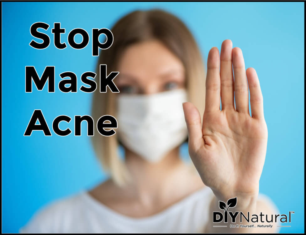 How to Get Rid of Mask Acne