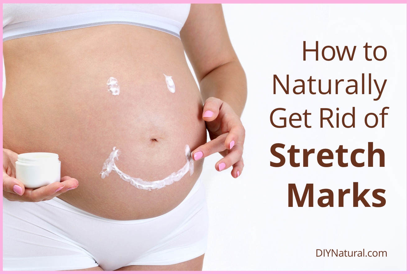 Retail Store Stretch Marks