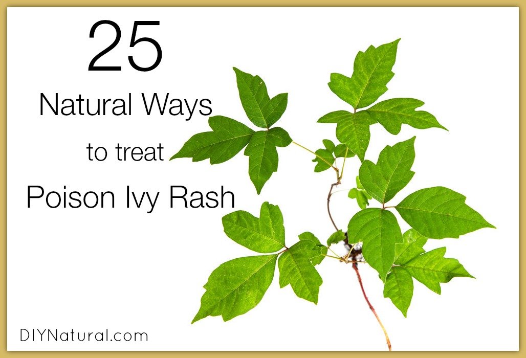 Poison Ivy Treatment Along With 25 Other Natural Rash Remedies,Studio Layout